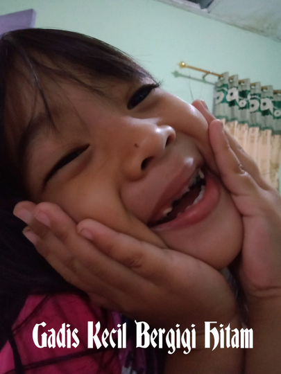 Gadis Kecil Bergigi Hitam