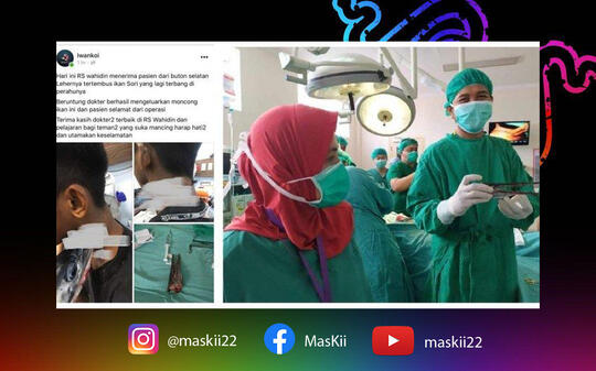 Inilah Fakta Ikan Sori yang Menancap Leher Pelajar SMP