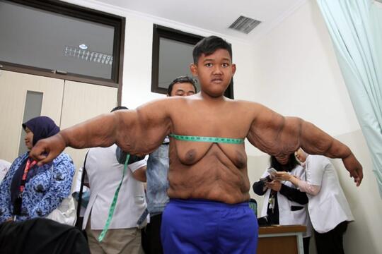 Arya Permana, Contoh Nyata di Mana Ada Kemauan dan Bantuan di Sana Ada Perubahan