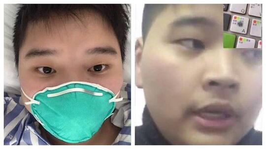 Pengakuan Korban Sembuh dari Virus Corona:Saya yang Pertama Pulih dari Kondisi Kritis