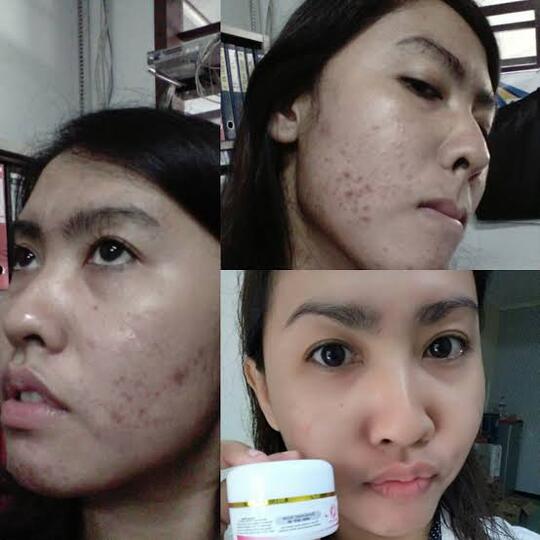 Gan Sist, mending ke Klinik Kecantikan atau nyobain pake Skincare?