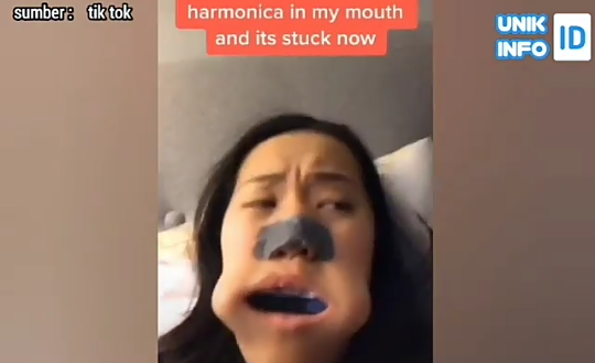 Harmonika Nyangkut di Dalam Mulut karena Main Tik Tok, Wanita ini Kebingungan!