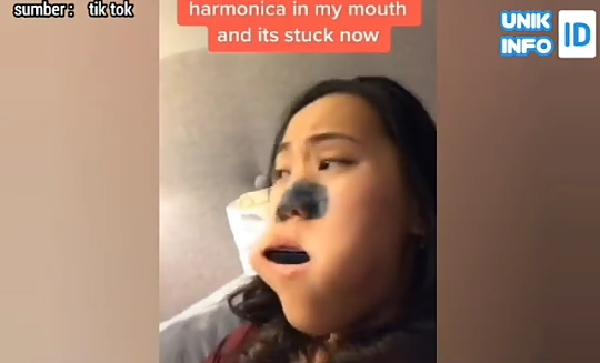 Harmonika Nyangkut di Dalam Mulut karena Main Tik Tok, Wanita ini Kebingungan!