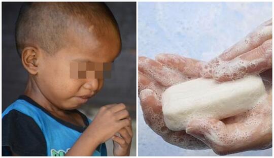 Indonesia jadi Negara Maju, Tiga Bersaudara Makan Sabun Cuci untuk Bertahan Hidup!