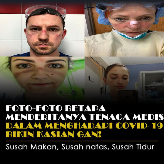 Foto-Foto Betapa Menderitanya Tenaga Medis Dalam Menghadapi Covid-19, Kasian Gan!