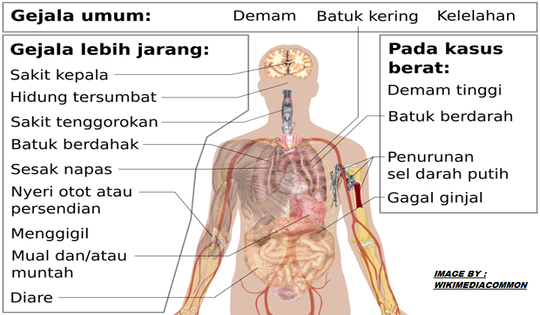 Dapatkah Vitamin D Menjadi Upaya Untuk Mencegah Penularan Risiko COVID-19?