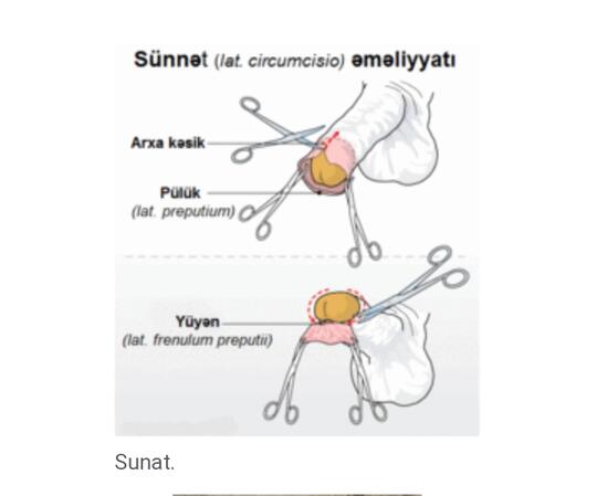 Sudah Sunatkan Kalian?