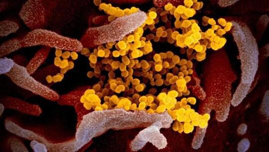 Viral Bupati Pidie Bicara Virus Corona Senjata Biologis, Ini Penjelasan Pemkab