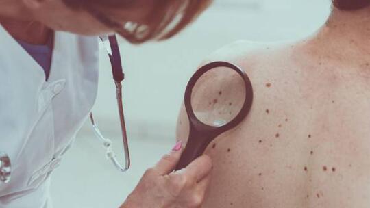 Sinar Matahari Bikin Kanker? Sunblock dan Sunscreen Bisa Mencegahnya?