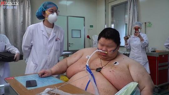 5 Bulan Lockdown, Berat Badan Orang Ini Naik Jadi 279 Kg