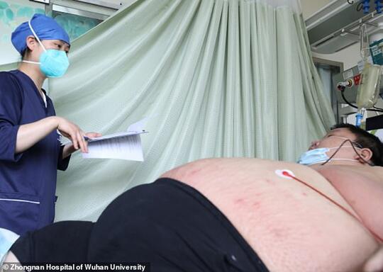 5 Bulan Lockdown, Berat Badan Orang Ini Naik Jadi 279 Kg