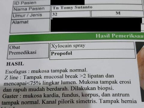 Kasihan, Pria Ini Dilarang Makan Mie Instan Seumur Hidup. Ada Apa Gerangan?