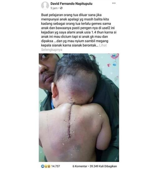 Tragis! Jangan Mencium Balita Dengan Paksa Jika Tak Ingin Ini Terjadi