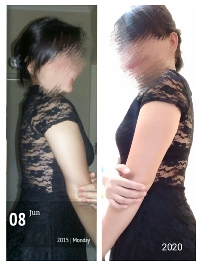 Transformation