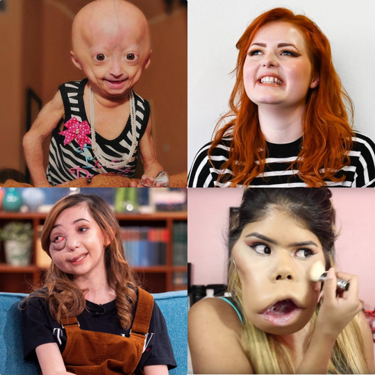 Inspiratif! Meski Fisik Tak Sempurna, 4 Wanita Ini Bisa Menjadi Youtuber Sukses
