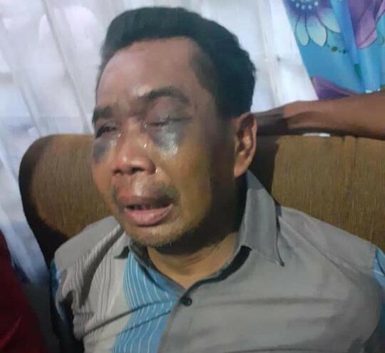 Pak Sarpan, Saksi Kasus Pembunuhan Itu Akhirnya di Pulangkan Meski Wajah Lebam