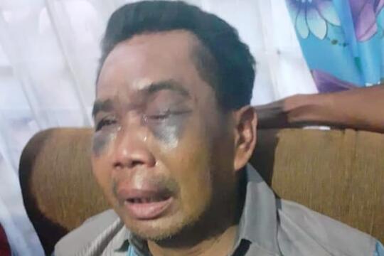 Saksi Pembunuhan Babak Belur Dianiaya Oknum Polisi, Kapolsek di Medan Dicopot