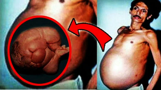 Berikut Manusia Unik Dengan Kemampuan Abnormal, Aneh Atau Unik Ya?