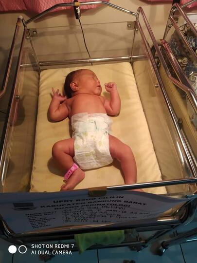Gara-gara Salah Diagnosa Bayi Lahir Sungsang Dan Nyawa Hampir Melayang