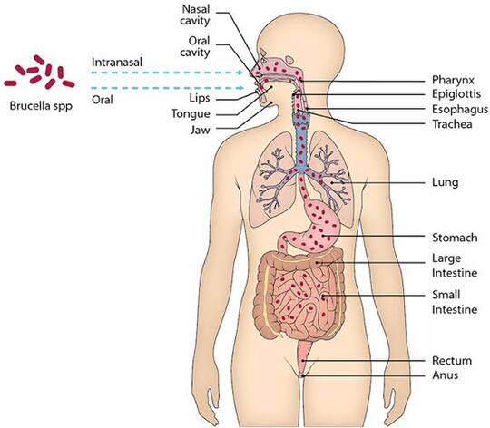 China Setelah Menularkan Virus Covid Kini Timbul Bakteri Brucellosis