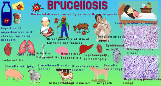 China Setelah Menularkan Virus Covid Kini Timbul Bakteri Brucellosis