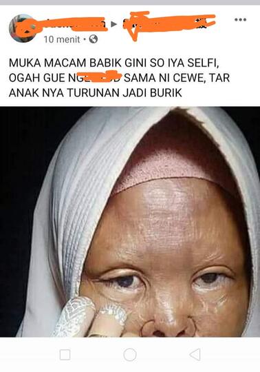 Dibully Karena Kekurangan Fisik, Wanita Ini Tetap Bersyukur Dan Percaya Diri