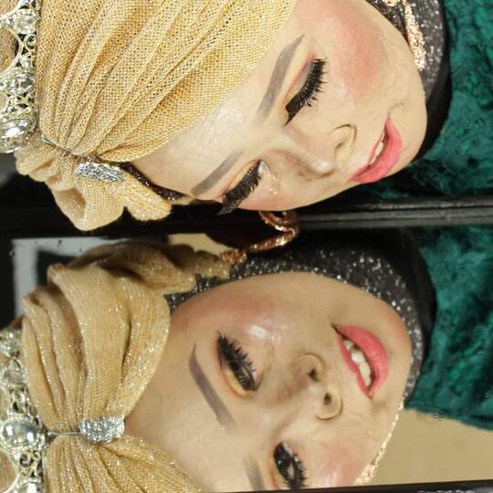 Dibully Karena Kekurangan Fisik, Wanita Ini Tetap Bersyukur Dan Percaya Diri