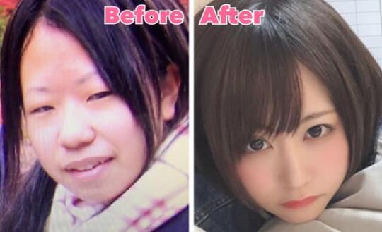 Heboh! Foto Hasil Oplas 'GADIS CANTIK JEPANG' Ini Mencuri Perhatian Netizen !