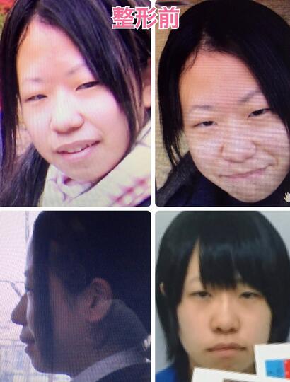 Heboh! Foto Hasil Oplas 'GADIS CANTIK JEPANG' Ini Mencuri Perhatian Netizen !