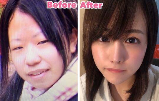 Heboh! Foto Hasil Oplas 'GADIS CANTIK JEPANG' Ini Mencuri Perhatian Netizen !