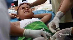 Kapan Usia Ideal Anak Laki-laki Disunat, Begini Kata Dokter!