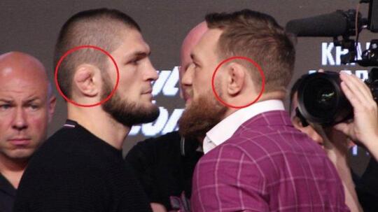 Mengapa Daun Telinga Khabib Dan Mc Gregor Aneh? Apa Semua Petarung MMA Begitu?