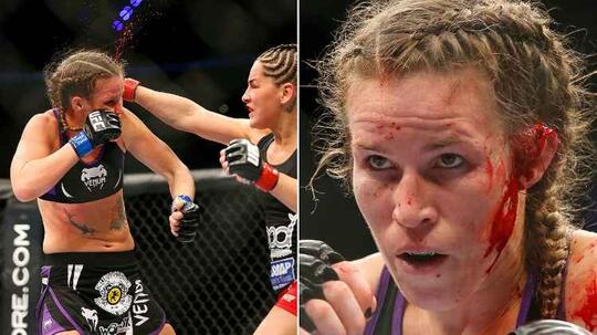 Mengapa Daun Telinga Khabib Dan Mc Gregor Aneh? Apa Semua Petarung MMA Begitu?