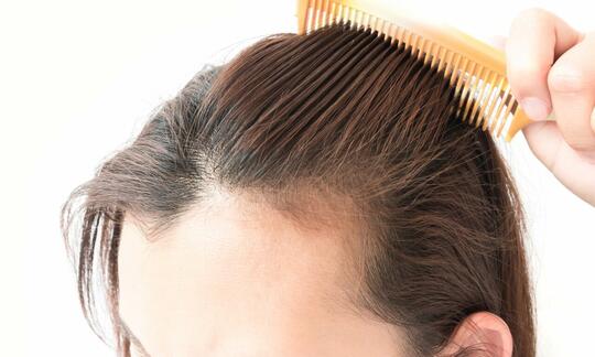 5 Makanan Yang Nyatanya Bisa Menjadi Penyebab Rambut Rontok