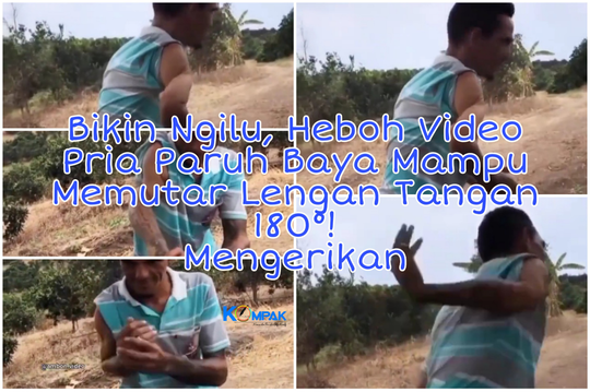 Bikin Ngilu, Heboh Video Seorang Pria Mampu Memutar Lengan Tangan 180°! Mengerikan