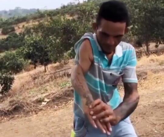 Bikin Ngilu, Heboh Video Seorang Pria Mampu Memutar Lengan Tangan 180°! Mengerikan