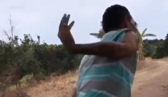 Bikin Ngilu, Heboh Video Seorang Pria Mampu Memutar Lengan Tangan 180°! Mengerikan