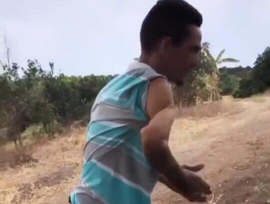 Bikin Ngilu, Heboh Video Seorang Pria Mampu Memutar Lengan Tangan 180°! Mengerikan