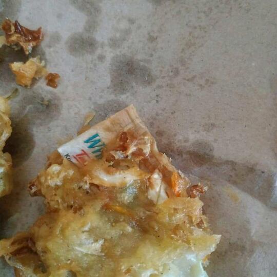 Gan, Selapar Apapun Perut Jangan Langsung Embat Aja Makanan, Atau Kayak Gini Jadinya!