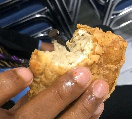 Gan, Selapar Apapun Perut Jangan Langsung Embat Aja Makanan, Atau Kayak Gini Jadinya!