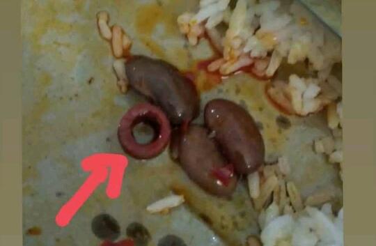 Gan, Selapar Apapun Perut Jangan Langsung Embat Aja Makanan, Atau Kayak Gini Jadinya!