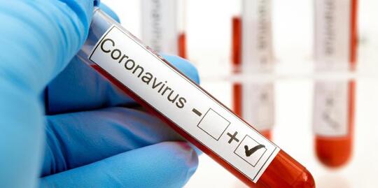 Epidemiolog: Riset Membuktikan 50 Persen OTG Covid-19 Mengalami Kerusakan Organ