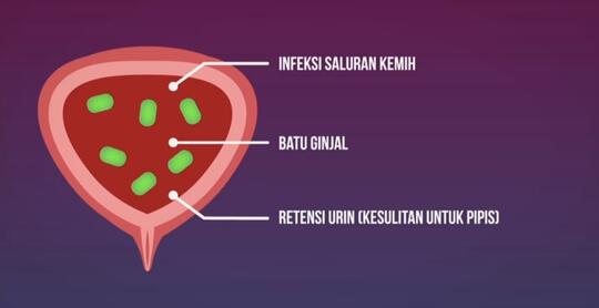 APA SIH BAHAYANYA MENAHAN PIPIS???