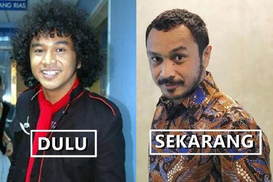 Kira-kira Mana Rambut Giring yang Cocok Buat Nyapres di 2024 Nanti?