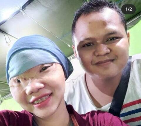 Sedih Gan!! Cinta Itu Tak Mengenal Rupa, Wanita Ini Menangis Dicintai Dengan Tulus