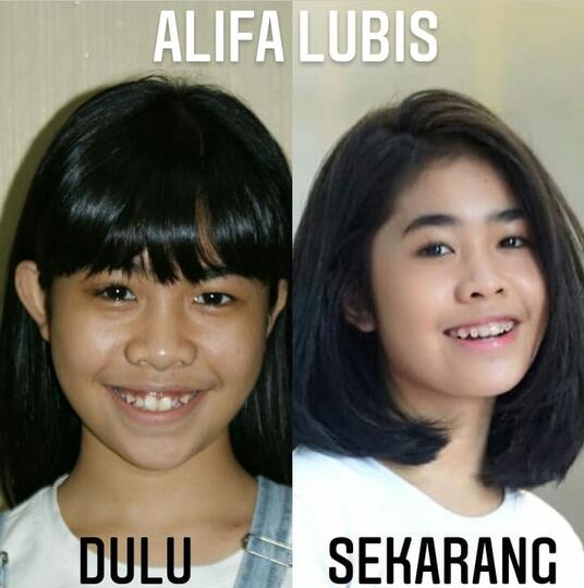 Aktris Cantik Alifah Lubis, Si Kecil Yang Aktif Sekarang Sudah Mulai Glow Up Loh!