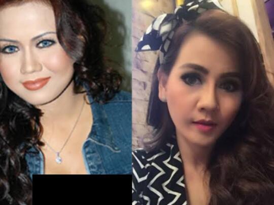 Demi Sebuah Penampilan, Artis Ini Rela Operasi Plastik, Ini Rincian Biayanya!