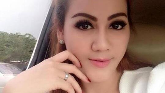 Demi Sebuah Penampilan, Artis Ini Rela Operasi Plastik, Ini Rincian Biayanya!