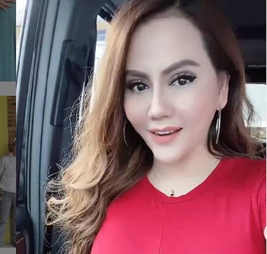 Demi Sebuah Penampilan, Artis Ini Rela Operasi Plastik, Ini Rincian Biayanya!