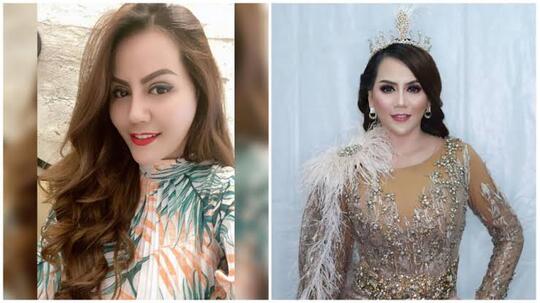 Demi Sebuah Penampilan, Artis Ini Rela Operasi Plastik, Ini Rincian Biayanya!